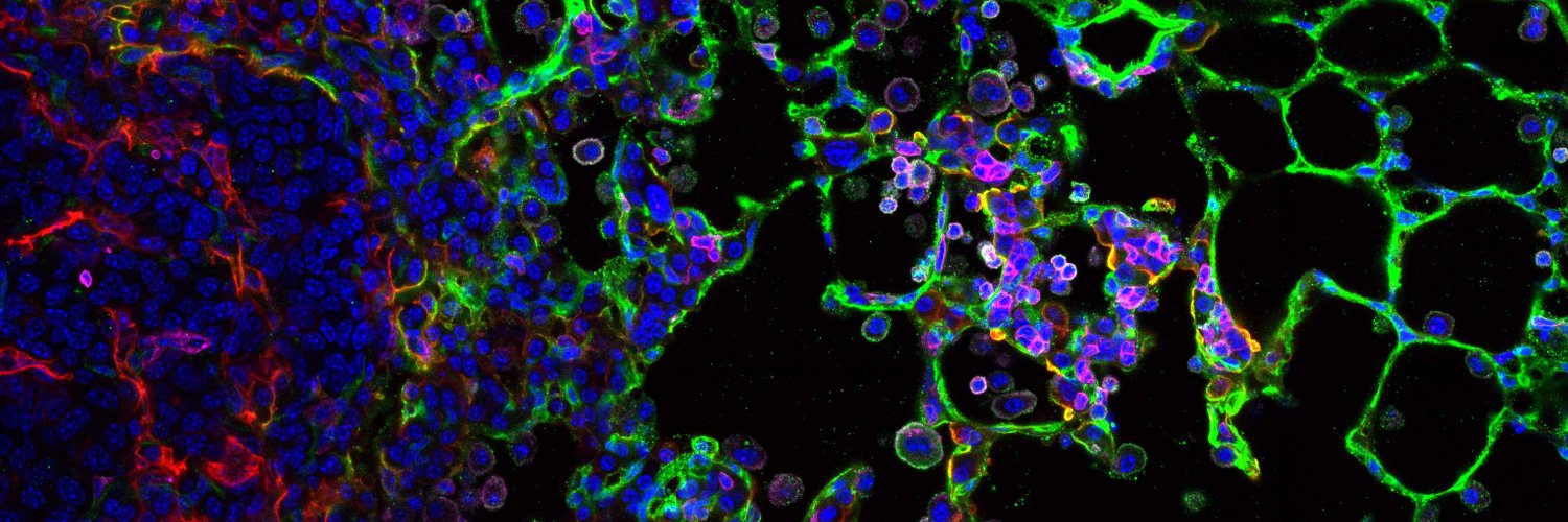 Marco De Donatis banner