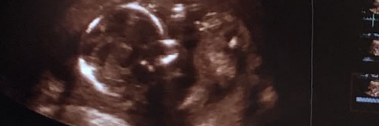 genesisbrit's profile banner image