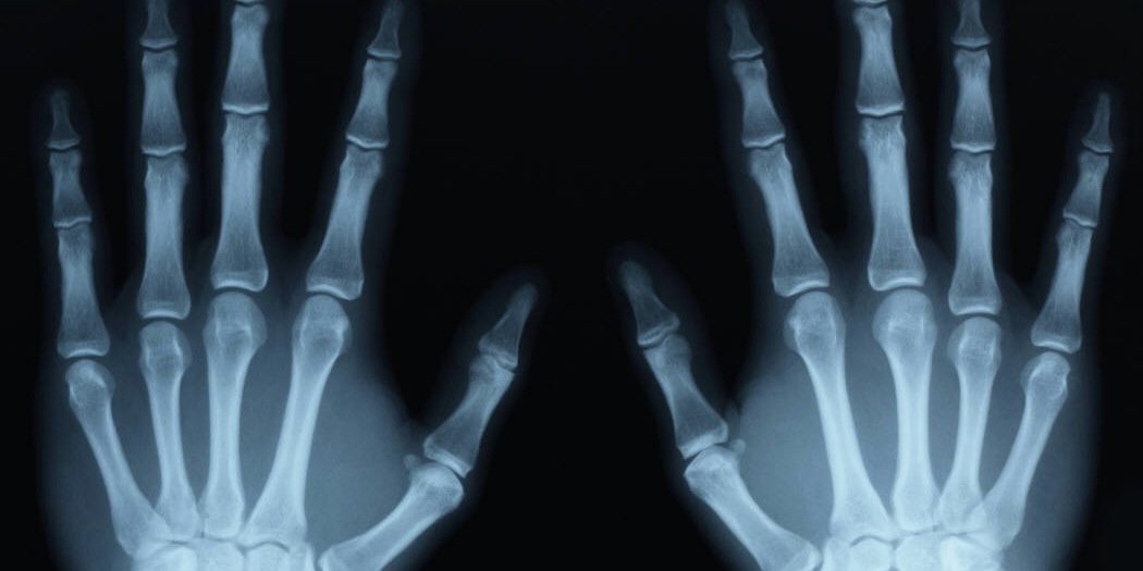 theboneguy11's profile banner image
