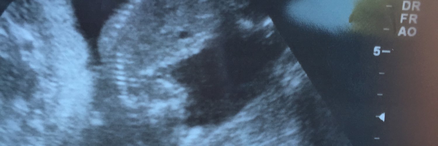 skyyyyyi's profile banner image