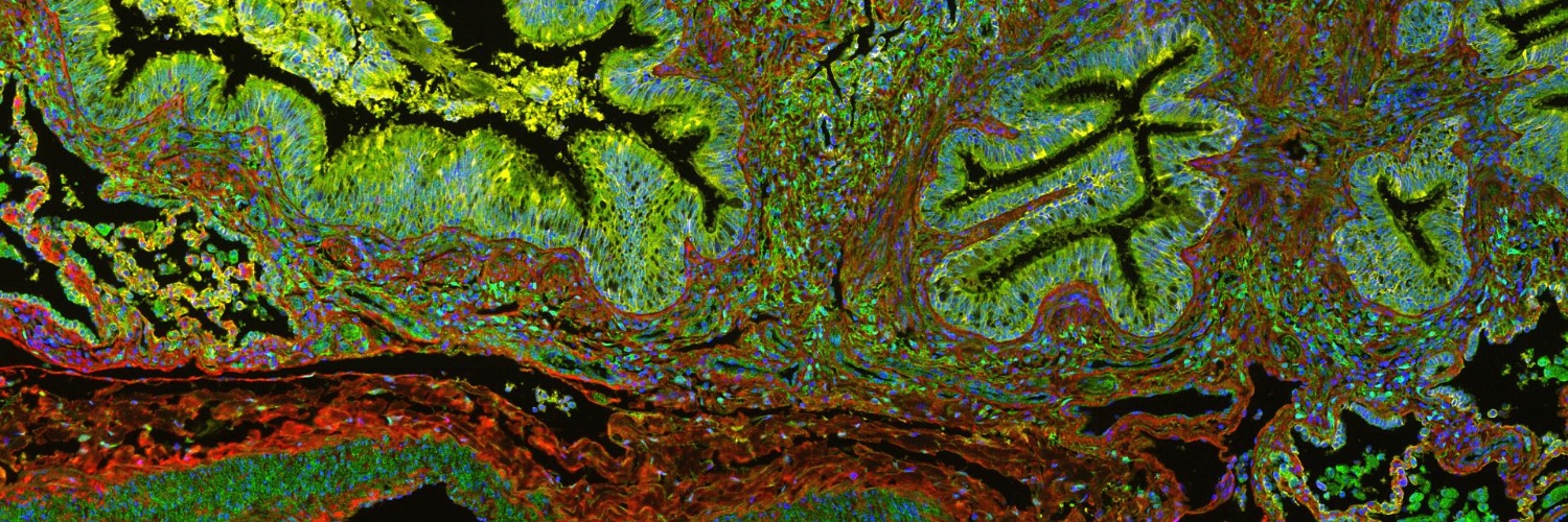 ATS RSF Assembly banner