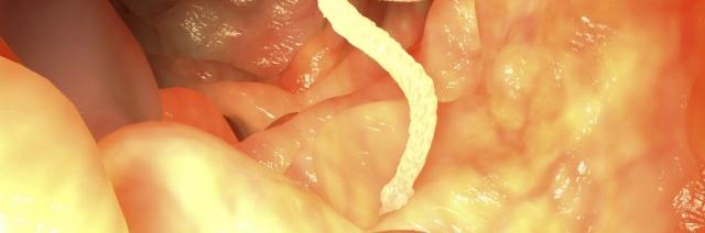 MagicTapeworm's profile banner image