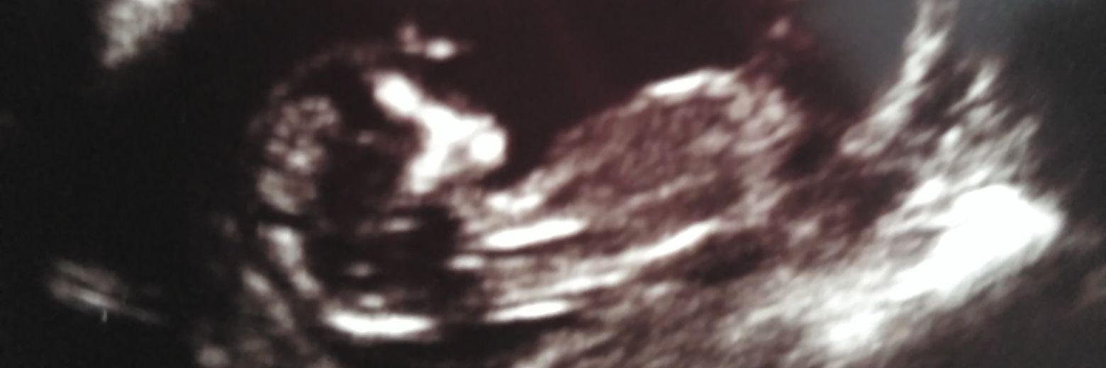jcarroyas's profile banner image
