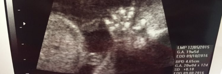 Moenique11's profile banner image