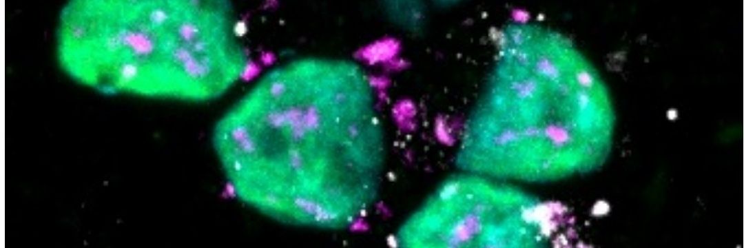 Francesco Castagnetti banner