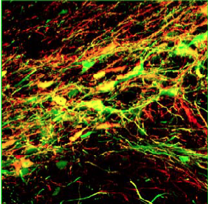 Laurie Sanders banner