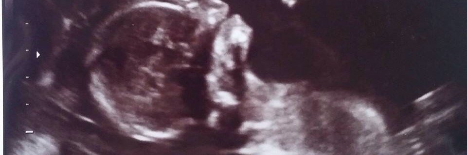 SPINA_621's profile banner image
