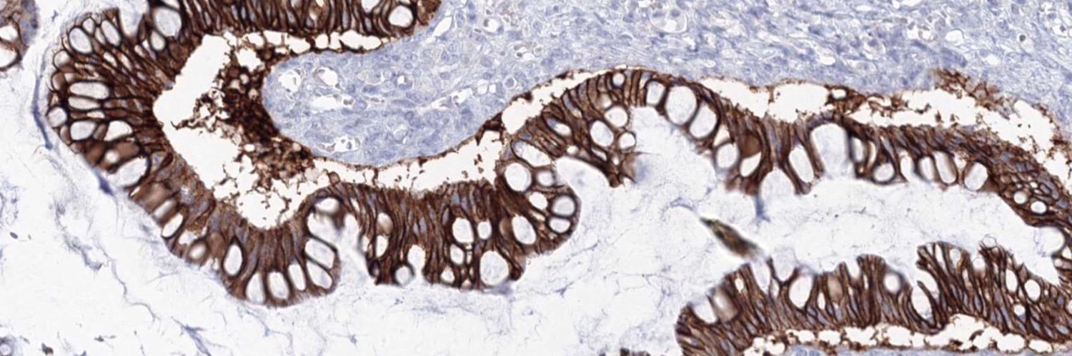 Matthew Wakefield banner