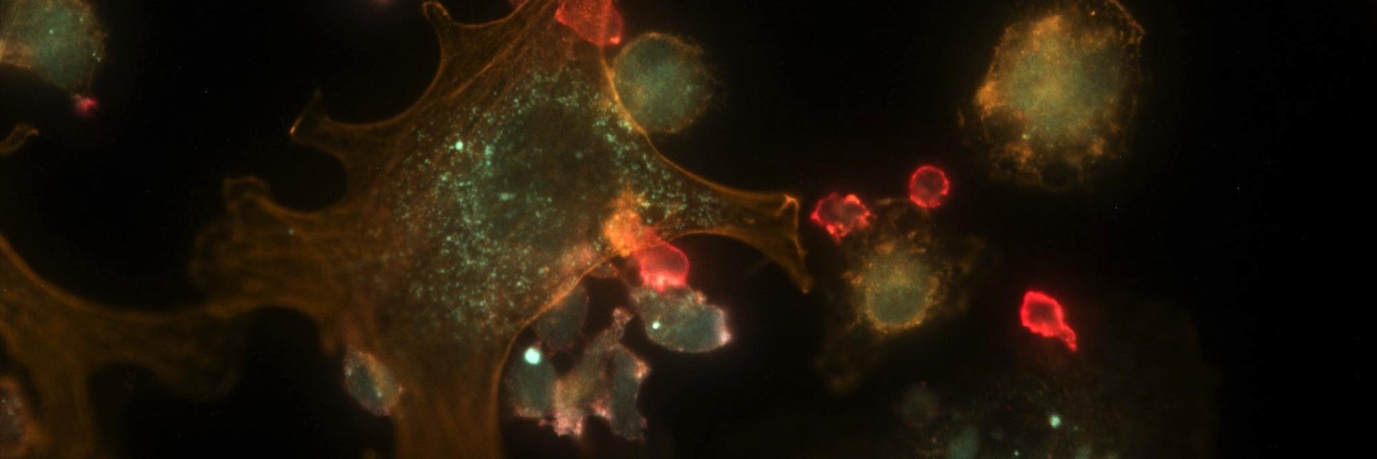 Xcell Biosciences banner