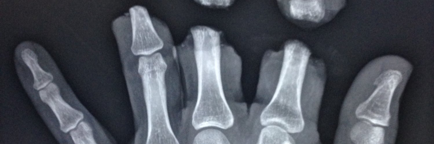 Jane 🤕🧠💛 banner