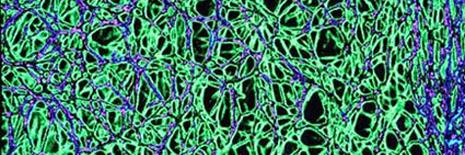 Hugo O'Connor banner