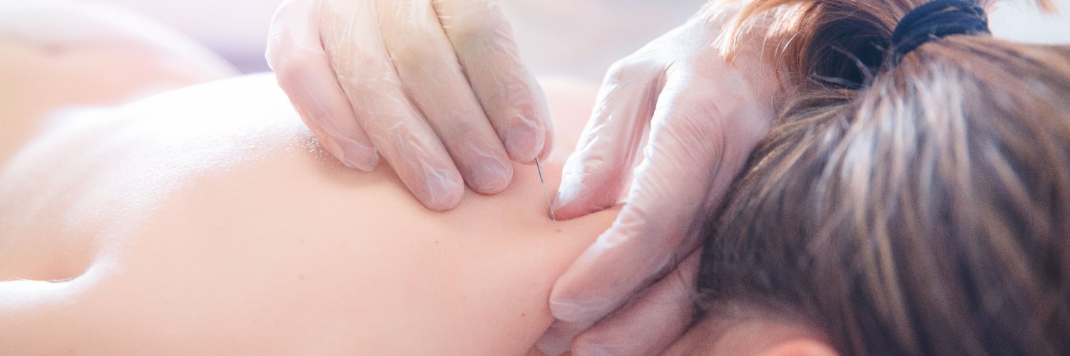 Acupuncture_Can's profile banner image