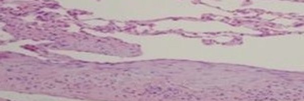 TodayIpf Profile Banner