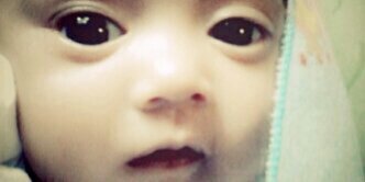 odhe suddenly banner