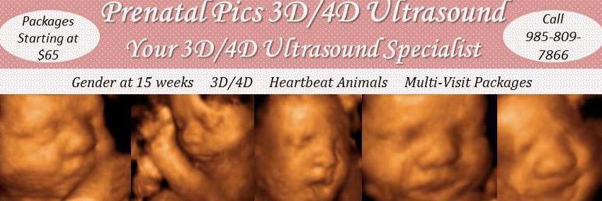 PrenatalPicsLa's profile banner image