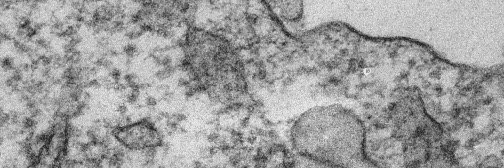 Denise Whitby banner