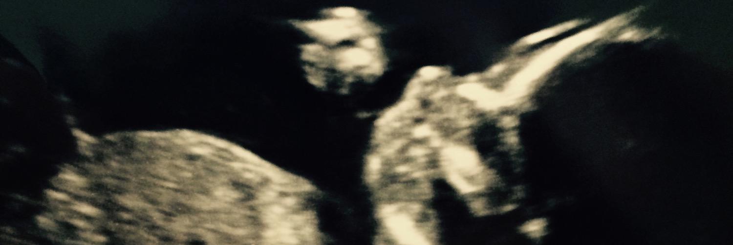 prettyone_'s profile banner image