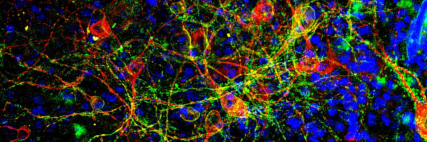 Eric Herlenius banner