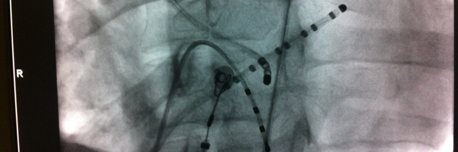 Rodrigo Isa Param banner