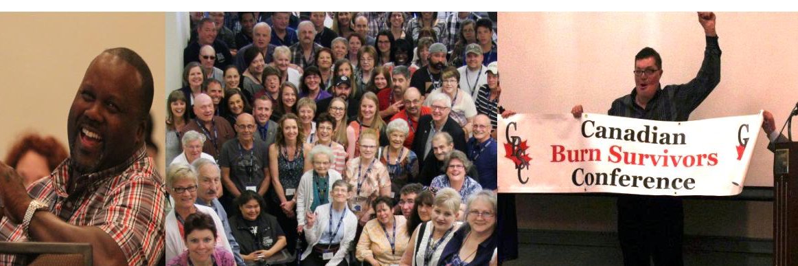 Canadian Burn Survivors Community banner