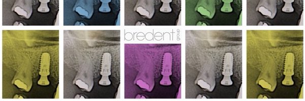 BredentSP Profile Banner