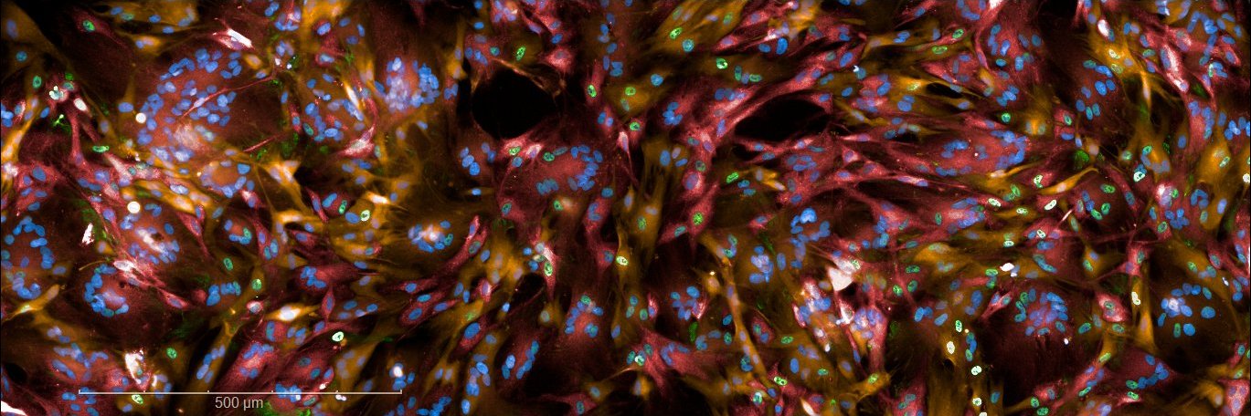 Adithya Pallepati banner