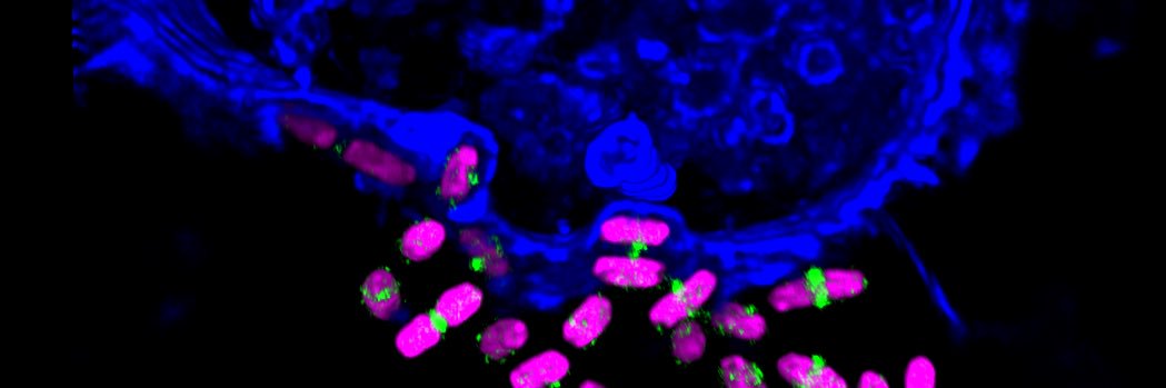 Australian Institute for Microbiology & Infection's banner