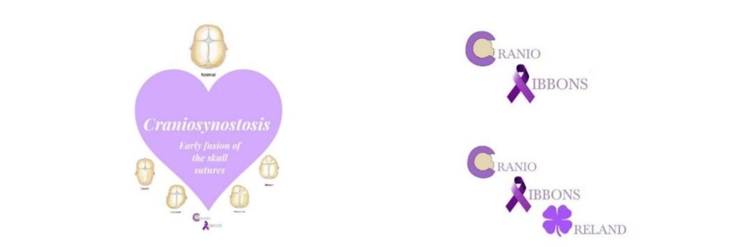 Cranio Ribbons banner
