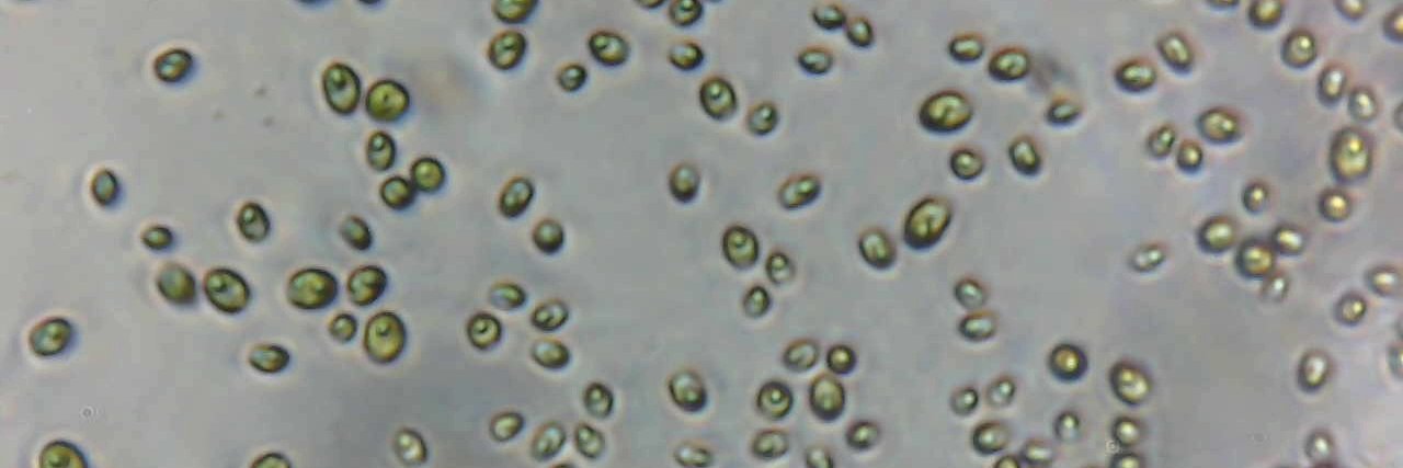 Hannah Laeverenz-Schlogelhofer banner