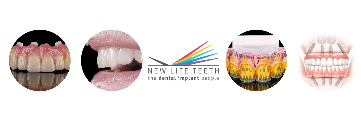 NewLifeTeeth's profile banner image