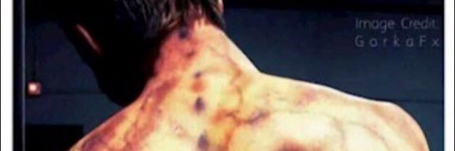 AManWithFibro's profile banner image
