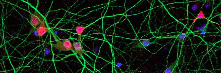 MPI for Brain Research's banner