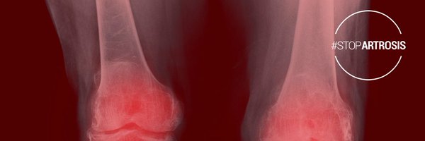 StopArtrosis Profile Banner