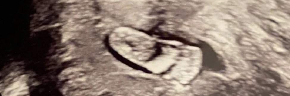 Lewend Mayiwar banner