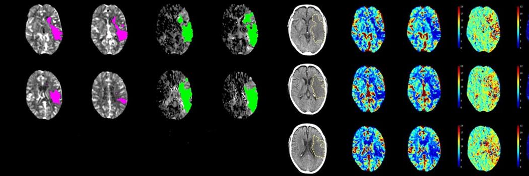 Stroke Telemedicine Service banner