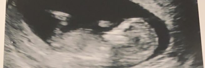 Billy_Abraham98's profile banner image