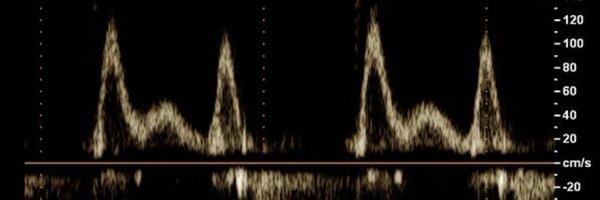 nat_echo Profile Banner