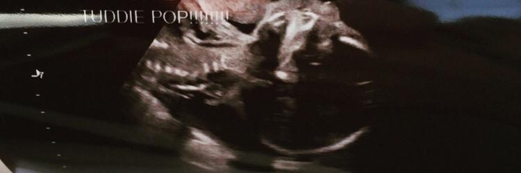 MyEishaJackson's profile banner image