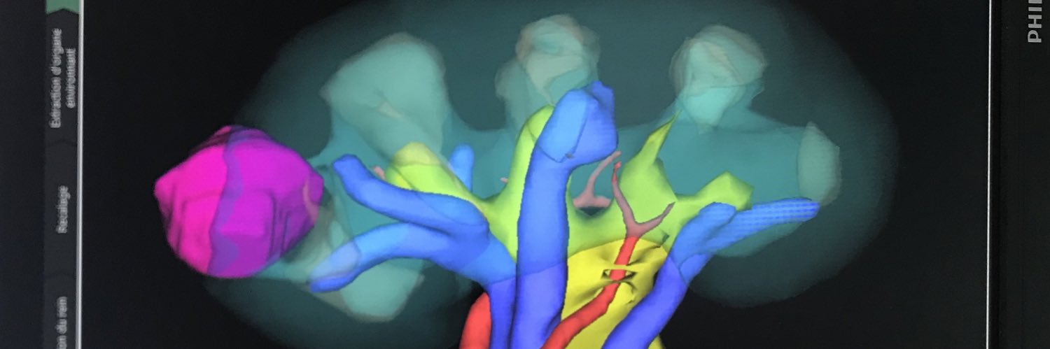 Xavier Tillou banner