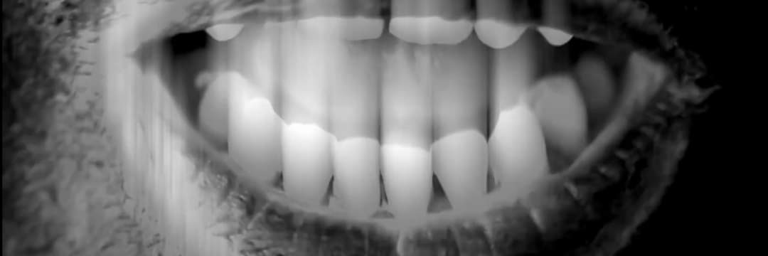 Ronny Jotten 🏴󠁧󠁢󠁥󠁮󠁧󠁿🇸🇮🇬🇧 banner