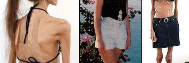 la_anorexia's profile banner image