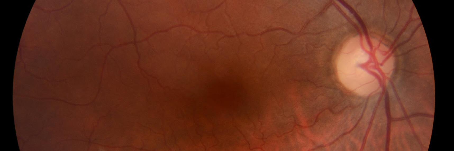 vampire_retina's profile banner image