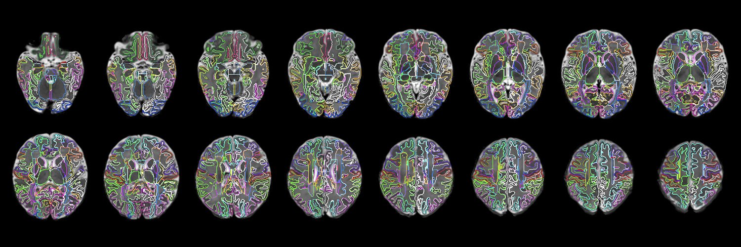 Bonnie Alexander banner