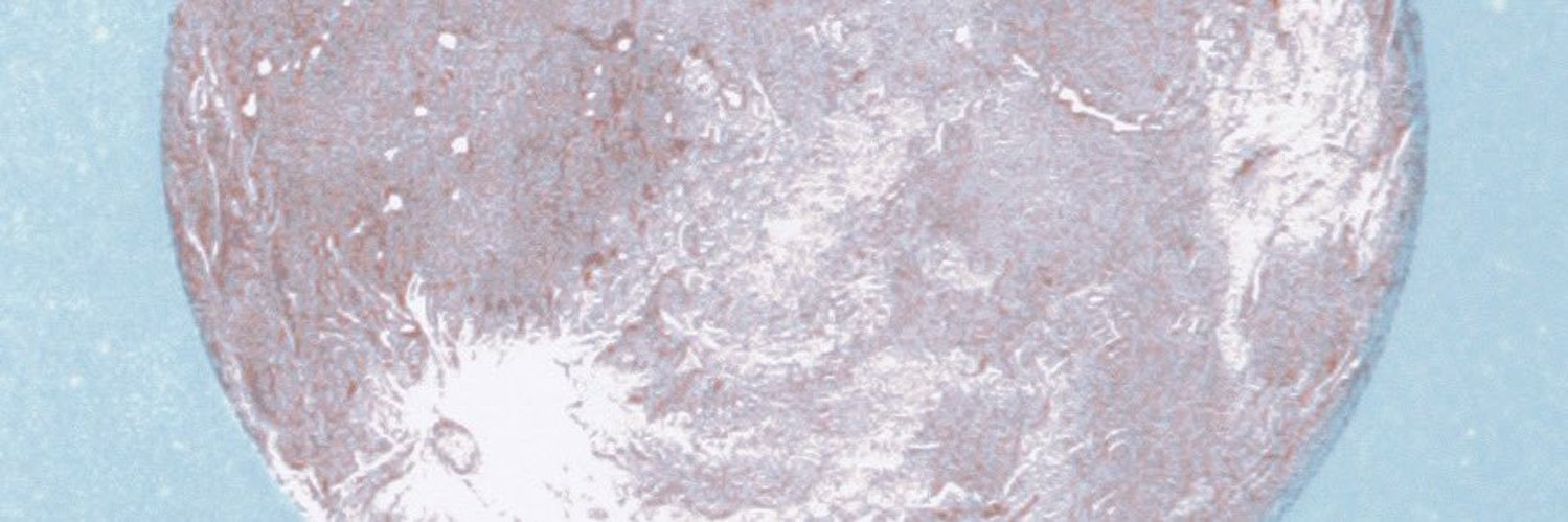 F banner