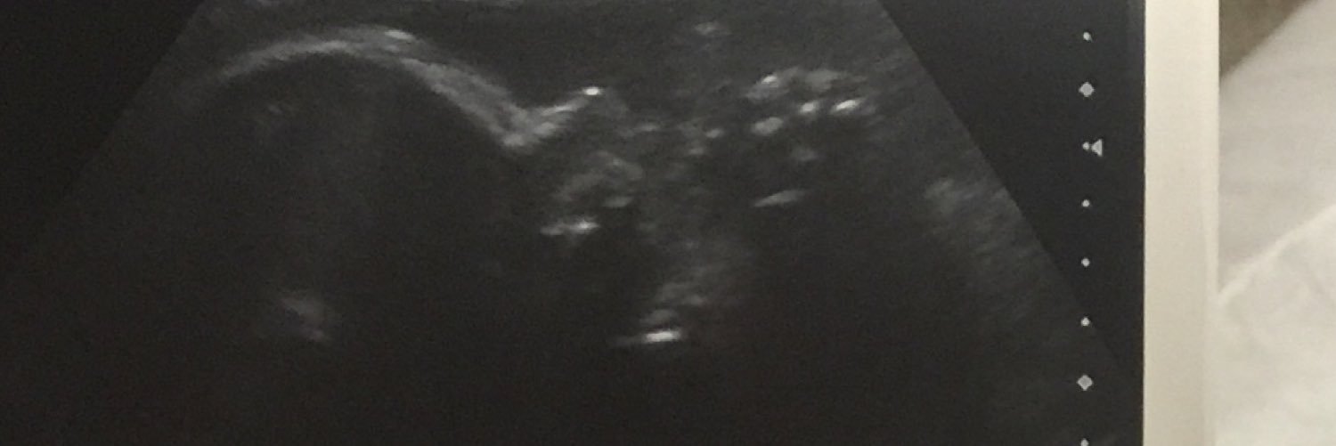 jacqueep17's profile banner image