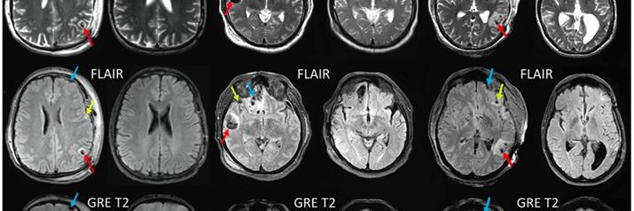 Rebecca Denniss, PhD banner