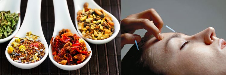 AcupunctureNow's profile banner image