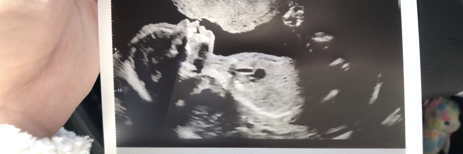 Trinity Love🤍 banner