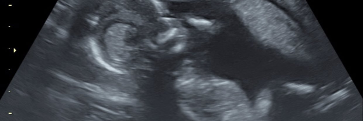Jwhite40211's profile banner image