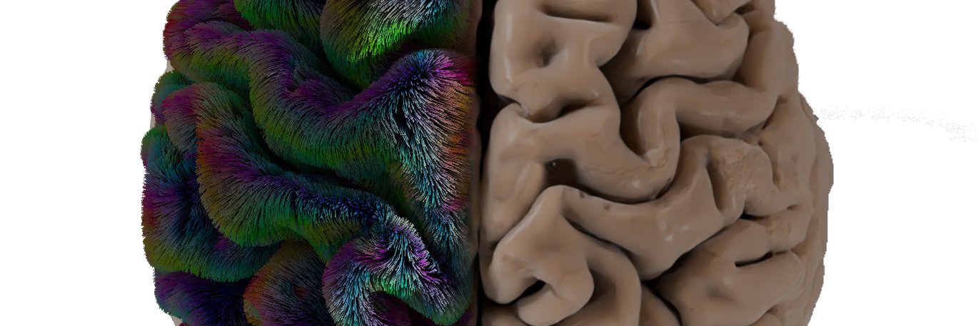 Maxime Chamberland banner